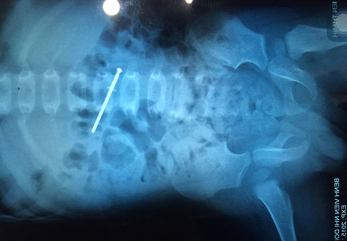 1448263162-bac3 Những 'sát thủ' giấu mặt khiến con bạn có thể mất mạng tại nhà - 2