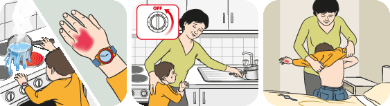 burn1 PIP-BurnsScalds-123-2311-1439001689.gif