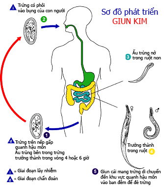 sodogiunkim-1411915456842 Nhận biết mắc giun kim